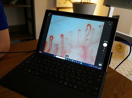 新富町の「ホルミシスメディカルサロン」での血流チェック